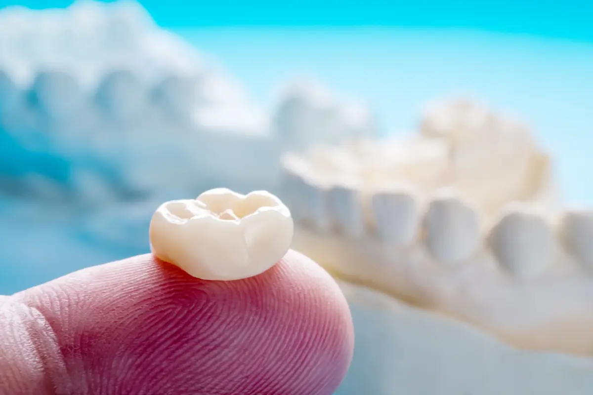 CEREC same-day crown care at Liberty Dental