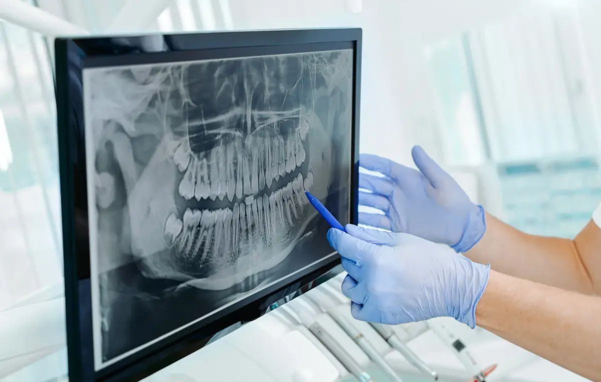 3D digital X-ray imaging at Liberty Dental
