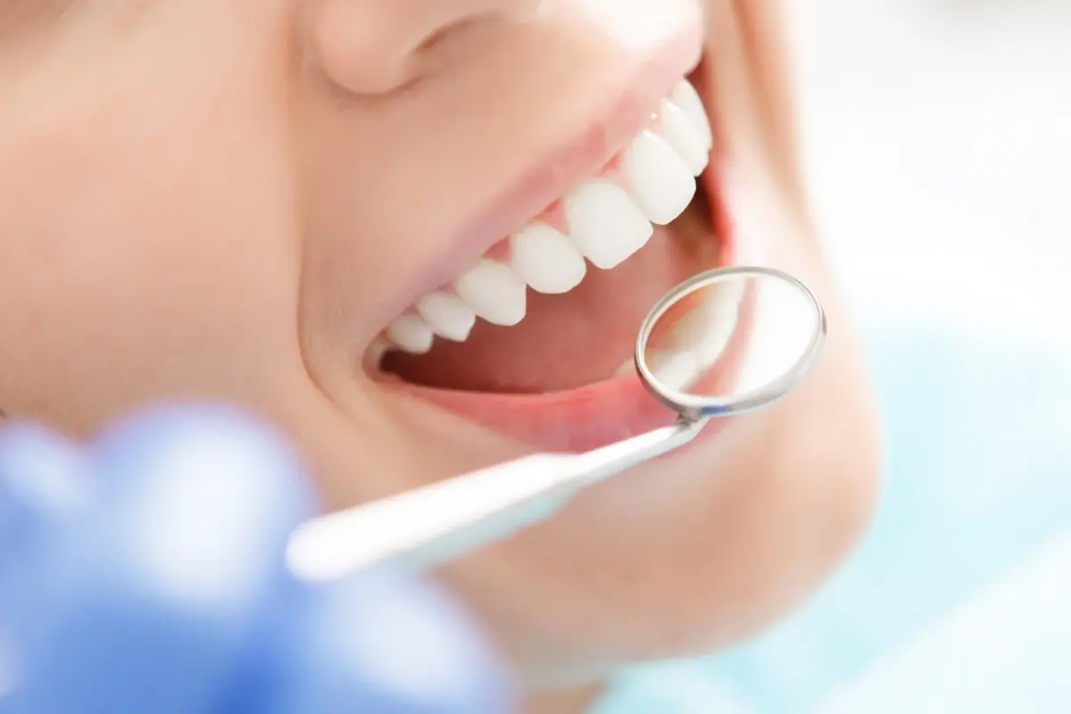 Teeth whitening visit at Liberty Dental