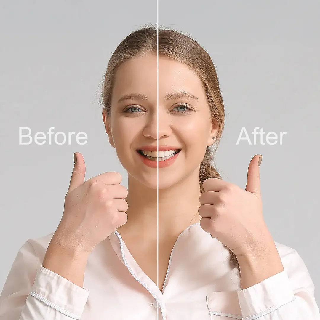 Smile makeover at Liberty Dental