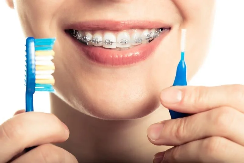 A Liberty Dental orthodontic care experience