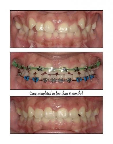 Invisalign care with one trusted team