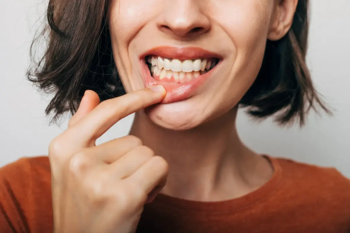 Healthy gums and a confident smile