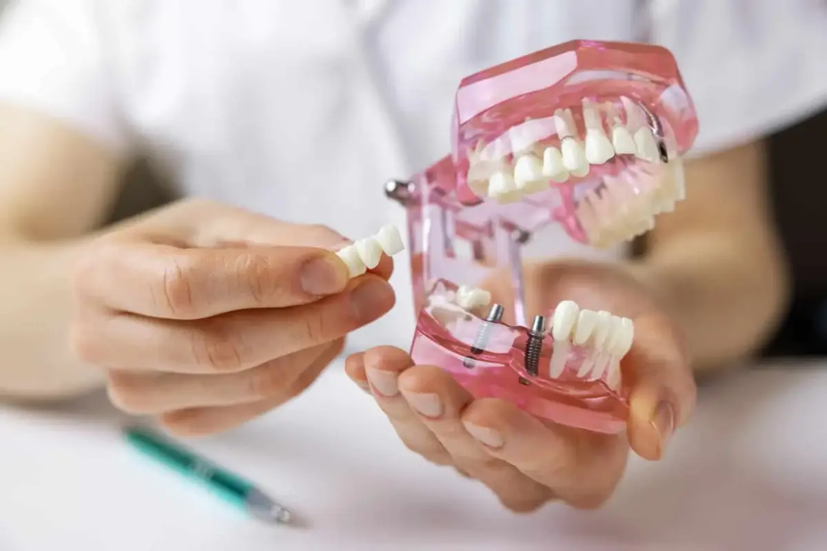 Dental bridge care at Liberty Dental